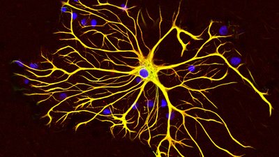 Beyinde 2 Yeni Gliya Hücresi Keşfedildi!