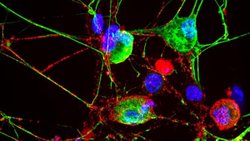 Proteazom Nedir? Nöronal Membran Proteazomlar Nörolojik Sağlığın Korunmasında Nasıl Bir Rol Oynarlar?
