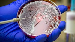 Et Yiyen Bakteri Hastalığı