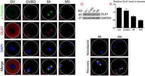 Conserved GTPase OLA1 Essential For Efficient Translation Of D/E-Rich MRNA