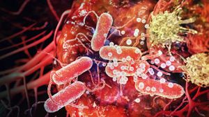 Salmonella Shows Potential To Transform Bowel Cancer Treatment