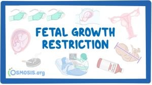 New Model Predicts Fetal Growth Restriction Using Medical History