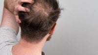 EU Regulator warns of suicide risk linked to hair loss drug Finasteride - Shia Waves