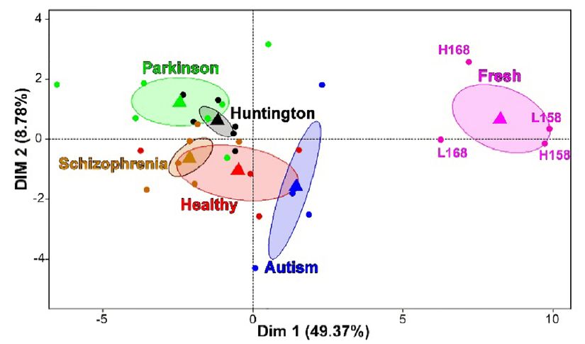 Fig.2 - Epileptik aktiviteden bağımsız olarak ölüm sonrası örnekler arasında en çok anlatımda azalma gösteren genler. Her nokta verilen örnekle örtüşüyor, kütle merkezleri üçgenlerle gösteriliyor ve kütle merkezlerinin %80’ni pozisyonlarını koruyor. İki ayrı hastadan (EP158 ve EP168) alınan 4 örneğin analizi görünüyor. Burada “L” (low) düşük aktiviteli beyin bölgelerini gösterirken, “H” (high) yüksek aktiviteli beyin bölgelerini belirtir.