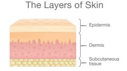 Epidermis