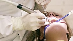 Diş Beyazlatma Nedir? Diş Beyazlatma Yöntemleri Nelerdir?