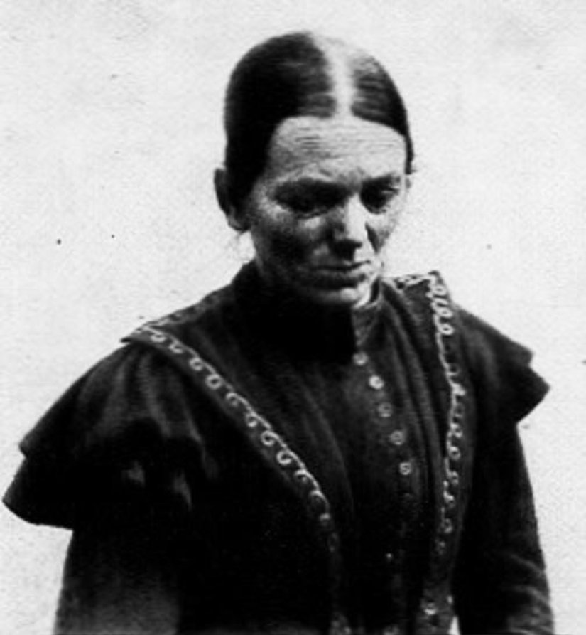 1788’te Naturalist Charles Bonnet, yürüyen ölü sendromu ilk vakalarından birini kayda geçiyor. Yaşlıca bir kadın yemek hazırlarken birdenbire bedeninin bir bölümü felç oluyor. Hissetme, hareket ve konuşma becerisini tekrar kazandığında ise kızlarına kendisini kefene sarmalarını ve tabuta koymalarını; kızlarının, arkadaşlarının ona günlerce ölüymüş gibi davranmasını istiyor. Sonunda onu kefene sarıp yatırıp ağıt yakıyorlar. Birtakım otlar ve değerli taşlarla yapılan tedavinin ardından aylar sonra bu sendrom ortadan kayboluyor. İşte bundan yaklaşık 100 yıl sonra Fransız nörolog Jules Cotard sıra dışı bir şikâyet ile karşılaştı.  Mademoiselle X adlı hastası Cotard’ın notlarına göre “beyni, sinirleri, göğsü, midesi ve bağırsakları olmadığını aynı zamanda da kendisinin ölümsüz olduğunu ve sonsuza kadar yaşayacağını söylüyordu. Ölümsüz olduğunu düşündüğünden yemeye ihtiyaç duymadı ve kısa süre sonra açlıktan öldü.” Cotard’ın bu kadına yönelik yaptığı tıbbi tanımlama geniş bir alana yayıldı ve etkili oldu ve bu bozukluk en nihayetinde onun adıyla anılmaya başlandı.