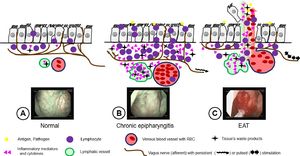 Revolutionizing Long COVID Treatment: Epipharyngeal Abrasive Therapy Shows Promise