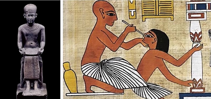 Antik Mısır Tıp Freskleri ve İmhotep heykeli. MÖ 27. yüzyılda yaşamış olan İmhotep, III. Hanedanlık döneminde Firavun Djoser'in başveziri, başmimarı ve hekimidir. Tıbbın babalarından biri olarak kabul edilir. Antik Mısır'da tıp alanındaki bilgileri ve uygulamaları derlemiş ve sistematize etmiştir.