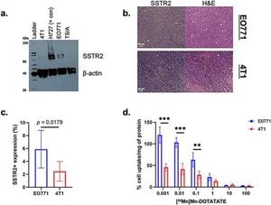 New Study Identifies Target For Triple-Negative Breast Cancer Treatment