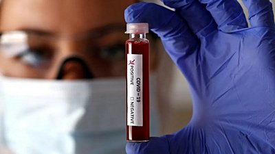 Nihai İlaçlar Geliştirilene Kadar Kan Nakli Tedavisi Koronavirüs Salgınında Dostumuz Olabilir!