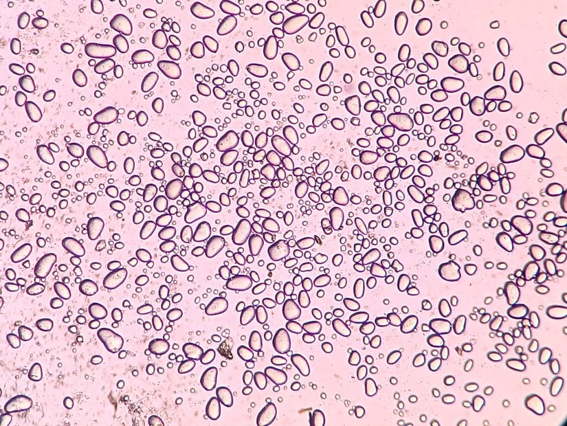 Şekil 1. Patates Nişastası, 100x