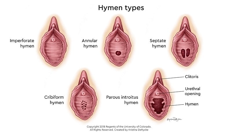 Farklı hymen tipleri