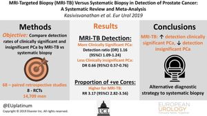 New Study Enhances Prostate Cancer Detection Through Improved Biopsy Techniques