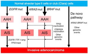 New Study Unveils Insights Into Lung Adenocarcinoma Progression