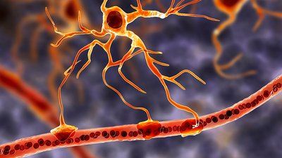 Fransız Dağ Köyündeki Gizemli ALS Salgını: Suçlu Zehirli Mantarlar mı?