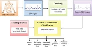 New Hybrid Deep Learning Model Revolutionizes ECG Arrhythmia Detection