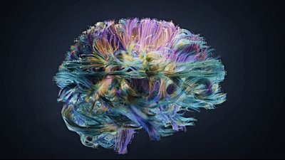 Beynin Hangi Özellikleri İnsan Zekası ile İlişkili Olabilir? Arayış Sürüyor!