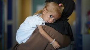 Gaza Toddler Finds Hope After Evacuation To Italy