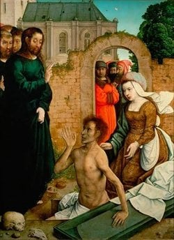 Lazarus Sendromu denen olaylarda beyin ölümü gerçekleşir mi?