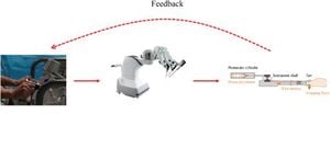 Saroa Surgical System Reduces Tissue Damage In Robotic Surgery