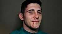 Saints fly-half ANTHONY BELLEAU on his horror mouth injury