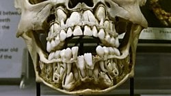 Neden Süt Dişlerimiz Var? Sadece İnsanlarda mı Süt Dişleri Var?