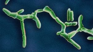 Listeria Outbreak Claims Infant Life And Triggers Massive Recall