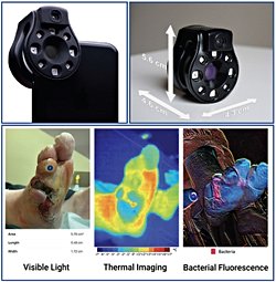 Klinisyenlerin enfekte yaraları daha hızlı tespit etmelerine yardımcı olabilecek cep boyutunda bir cihaz geliştirildi.