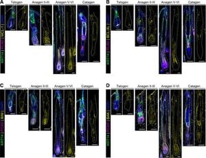 Key Protein MCL-1 Plays Crucial Role In Hair Follicle Regeneration