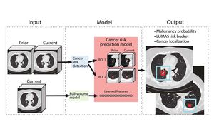 New Deep Learning Model Enhances Lung Nodule Segmentation Accuracy