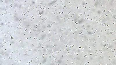 Bakteriler (Bacteria)