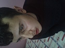 gözüm bademi normal mi düz mü hangi renk?