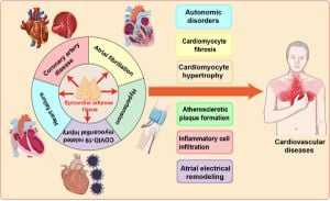 Epicardial Adipose Tissue Linked To Atrial Arrhythmias After PCI