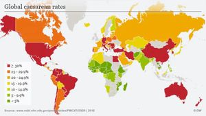 Rising Caesarean Section Rates Spark Global Concern