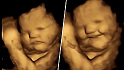 Bebekler Anne Karnında Tat ve Kokulara Tepki Verebiliyor!