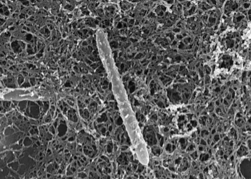 Desulforudis audaxviator'ın fotoğradı