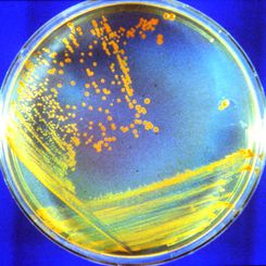 D. rad Bacteria: Candidate Astronauts