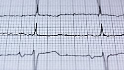 Nobele Göz Kırpan El Yazısı: E-K-G