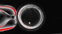 Push to create functional human eggs in the lab stumbles, pioneering fertility researcher reports