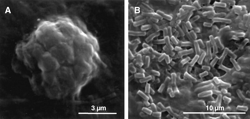 Metanotropik arkelerin gerçek mikroskop görüntüleri...