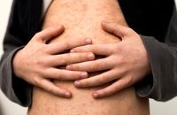 Lambton records first measles case in province-wide outbreak | The Independent