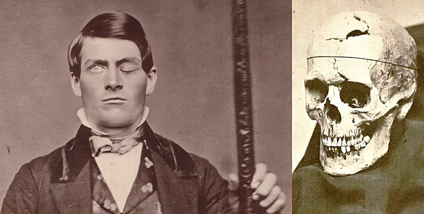 Prefrontal korteksinden bir demir geçen Gage'in iradesi neredeyse felce uğramıştı.