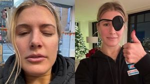 Eugenie Bouchard Injured During Pickleball Training