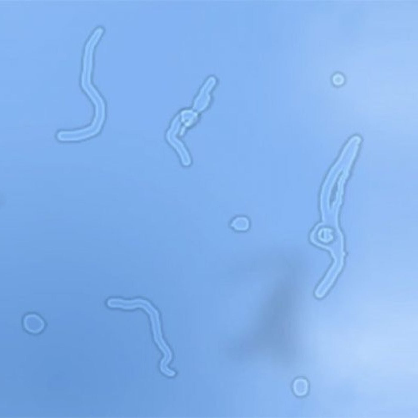 Yüzer Noktalar: Gözlerinizin Önünde Uçuşan Tuhaf Şekiller