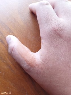 Bu sabah uyandığımda elimde anlam veremediğim kınaya benzer izler vardı. Yıkamama rağmen geçmedi sizce buna ne sebep olmuş olabilir?