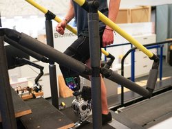 Şimdiye Kadarki En İyi Biyonik Bacak: Sinirsel Kontrol Sağlayan Protez Uzuv.