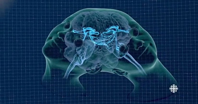 İkizlerin iki ayrı beyni vardır; ancak bu beyinler birbirinden ayrılamayacak şekilde bağlantılıdır. Bu bağlantıyı sağlayan parçaların bir kısmını oluşturan talamik köprü ve yaptığı bağlantılar fotoğrafta gözükmektedir.