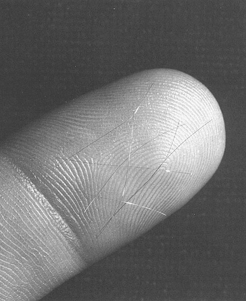 Needles from the MIT's Project Needles