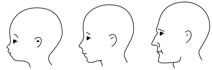 Bebek, çocuk ve yetişkinlerin kafa oranları